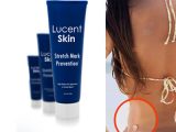 a review for lucent skin, a stretch mark removal cream